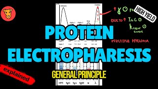 PROTEIN ELECTROPHARESIS and IMMUNOFIXATION Explained [upl. by Allit801]