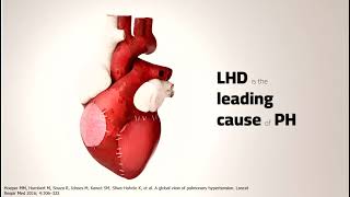 Pulmonary hypertension  Epidemiology and risk factors 01 [upl. by Zoubek276]