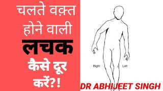 WADDLING GAIT  TRENDELENBURG GAIT  चलते वक़्त लचक कैसे ठीक करें  CORRECT WALKING PATTERN [upl. by Kenta]