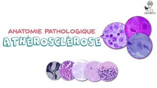 Anatomie Pathologique  Athérosclérose [upl. by Ecnaralc819]