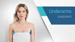 Treat sweaty underarms with Dermadrys iontophoresis machine [upl. by Hayward]