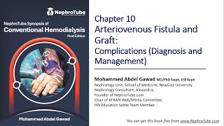 Hemodialysis Chapter 10 Arteriovenous Fistula amp Graft Complications  DrGawad Arabic Language [upl. by Yssenhguahs]