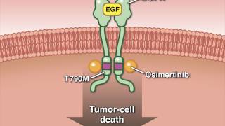 Osimertinib in Advanced Non–SmallCell Lung Cancer [upl. by Alvis]