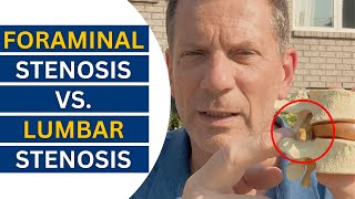 Foraminal vs Lumbar Stenosis Breakthrough Treatment Revealed  Dr John Zielonka [upl. by Nerak]