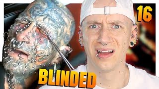 Reacting To Eyelid Piercing Fails  Piercings Gone Wrong 16  Roly Reacts [upl. by Seton527]