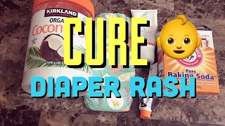 CURE DIAPER RASH FAST [upl. by Juditha19]