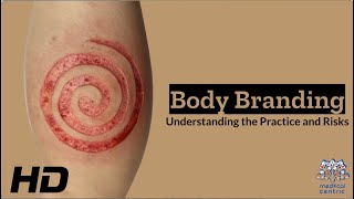 Body Branding Understanding the Practice and Risks [upl. by Htessil709]