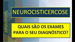 Como é feito o diagnóstico da neurocisticercose  Dr Marcelo José da Silva de Magalhães [upl. by Obeded650]