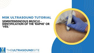 Ultrasound identification of the Semitendinosus muscle Raphe or Veil [upl. by Esmerelda]