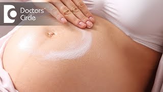 Do stretch mark creams really workDr Madhu SM [upl. by Assirok]