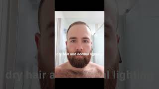 BALDING at 23  Finally Getting A Buzzcut  Part 17 [upl. by Socin]