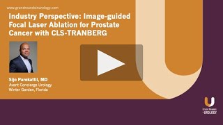 Industry Perspective Imageguided Focal Laser Ablation for Prostate Cancer with CLSTRANBERG [upl. by Kilby794]