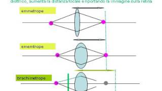 potere diottrico occhio umano [upl. by Gurtner746]