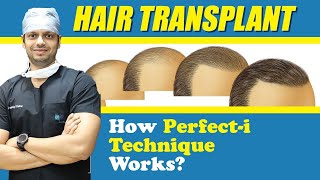 Medlinks Perfect i Hair Transplant Technique  Best Hair Transplant Technique  Dr Gaurang Krishna [upl. by Kreis]