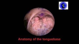 Anatomy of The Tongue Base [upl. by Naesar]