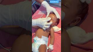 Newborn Nose Massage nicu newbornbaby medical [upl. by Ruckman]