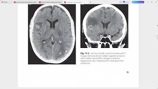 EMERGENCY CROSS SECTIONAL RADIOLOGY [upl. by Augustin]