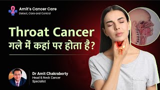 Top 5 Typical Locations for Throat Cancer  Throat cancer कहां होता है  Dr Amit Chakraborty [upl. by Lecia]