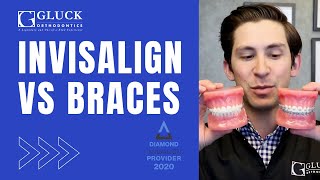 Invisalign vs Braces Tips from a Board Certified Orthodontist [upl. by Aela]