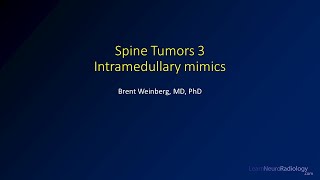 Spine tumors 3 – Intramedullary tumor mimics [upl. by Essex]