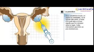 la fécondation in vitro la FIV [upl. by Esineg]