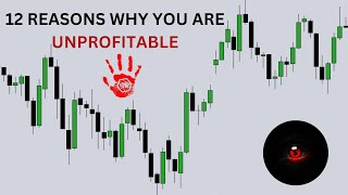 12 Reasons Why You Are Unprofitable In Trading [upl. by Niak]