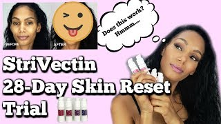 I Did the STRIVECTIN 28DAY SKIN RESET TRIAL  Skincare Review [upl. by Taro]