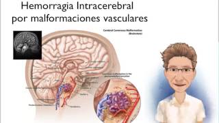 HEMORRAGIA INTRACEREBRAL CONCEPTO Y CLASIFICACIÓN [upl. by Ayik]