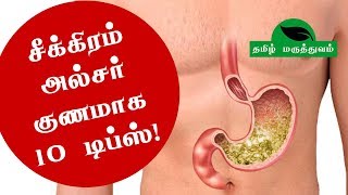 சீக்கிரம் அல்சர் குணமாக 10 டிப்ஸ் [upl. by Esiom]