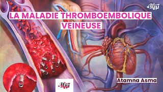 Physiopathologie La maladie thromboembolique veineuse Par Asma Atamna [upl. by Grier247]