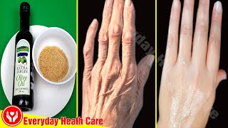 Only Use These 2 Ingredients  Removes Wrinkles On Your Hands Quickly [upl. by Gerita7]