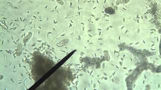 Protists Amoeba Euglena Paramecium [upl. by Eiser]