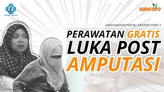 PERAWATAN LUKA POST OPERASI DENGAN CSWD  PERAWATAN LUKA GRATIS BY WOUND HUNTER [upl. by Torrey]