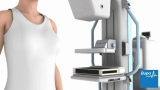 How a mammogram is carried out  Bupa Health [upl. by Anyek]