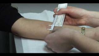 TB Skin Test  Mantoux Method [upl. by Westberg244]