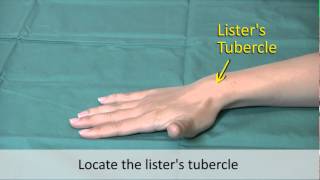 Musculoskeletal Examination and Joint Injection Series Wrist Joint Aspiration [upl. by Walden]