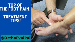 Top of the foot pain Treatment tips [upl. by Eihctir]