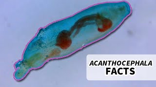 Acanthocephala Facts the Thorny Headed Worm  Animal Fact Files [upl. by Arik577]