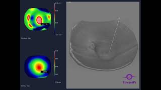 3D quotFundus Curvaturequot launched by TowardPi SSOCT [upl. by Cam]