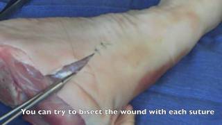 Suture  Basic Technique 2 [upl. by Yanehc729]