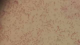 Gram Negative Bacteria Aeromonas hydrophila in Gram Staining [upl. by Johnath]