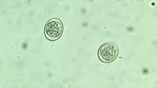 Unsporulated coccidian oocyst [upl. by Card]