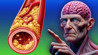 15 Miracle Foods to Purge Plaque from Your Blood Vessels [upl. by Hau473]