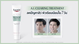 ผู้ชายเป็นสิวเยอะ จัดการด้วย Eucerin Pro ACNE SOLUTION AI CLEARING TREATMENT [upl. by Baryram]