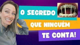 Elástico errado no aparelho 😰 aparelhoortodôntico Elástico intraoral [upl. by Connelly]