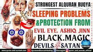 Ruqyah for the Treatment of Incurable Diseases Witchcraft Blackmagic Evil Eye amp Sleeping Problems [upl. by Yelmene557]