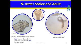 Hymenolepis nana Dwarf tapeworm Cestode [upl. by Neelahs]