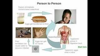 Cysticercosis and Neurocysticercosis Whos At Risk [upl. by Dabney]