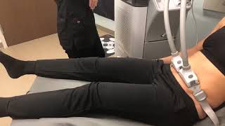 SculpSure Live Demo [upl. by Murdocca251]