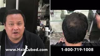 Repairs Hair Transplant With HairCubed® Amazing Results Call 18007191008 [upl. by Fabio]